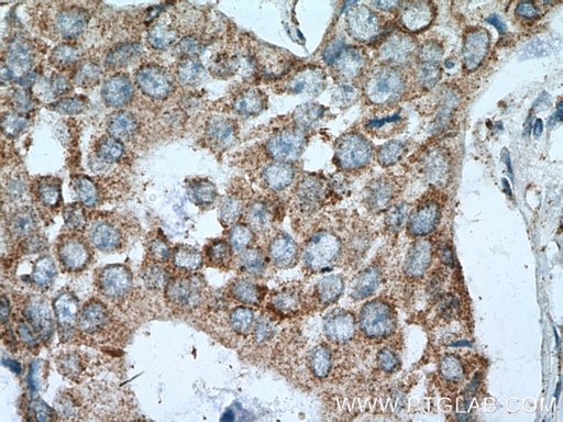 [17719-1-AP-20UL] P5CS Polyclonal antibody