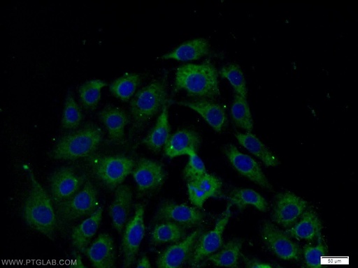 [17720-1-AP-20UL] CSK Polyclonal antibody