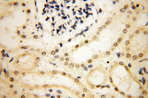 [17722-1-AP-150UL] SMARCC1 Polyclonal antibody