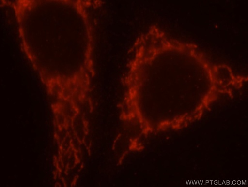 [17723-1-AP-150UL] SAMD4B Polyclonal antibody