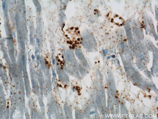 [17727-1-AP-150UL] BLVRB Polyclonal antibody