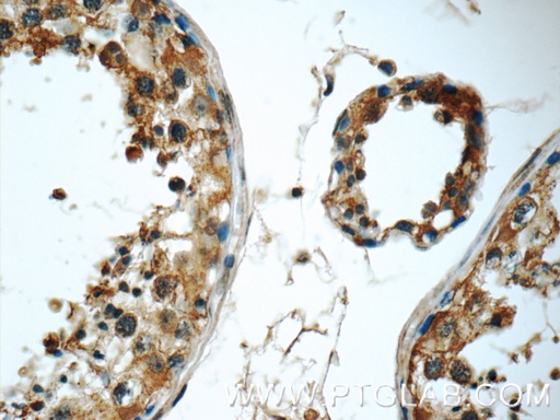 [17730-1-AP-150UL] TSNAXIP1 Polyclonal antibody