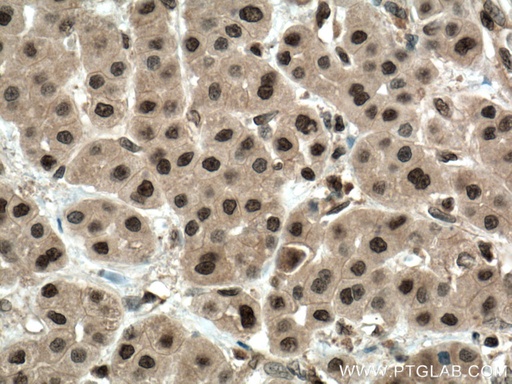 [17731-1-AP-20UL] ENOPH1 Polyclonal antibody