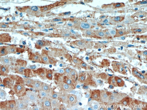 [17737-1-AP-150UL] EDC4 Polyclonal antibody
