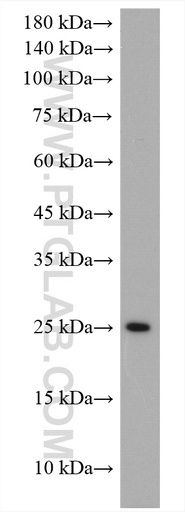 [17738-1-AP-20UL] Claudin 9 Polyclonal antibody
