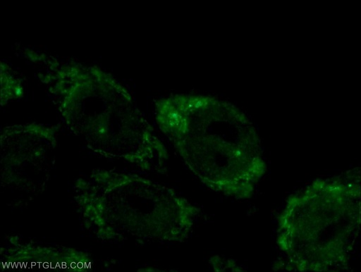 [17739-1-AP-20UL] CPSF2 Polyclonal antibody