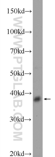 [17742-1-AP-20UL] DSN1 Polyclonal antibody