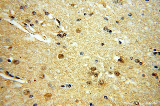 [17743-1-AP-150UL] YPEL1 Polyclonal antibody