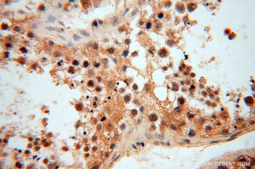 [17750-1-AP-20UL] LSG1 Polyclonal antibody