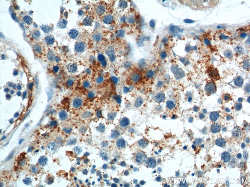 [17753-1-AP-150UL] SOHLH1 Polyclonal antibody