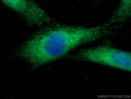 [17755-1-AP-150UL] RANBP9 Polyclonal antibody