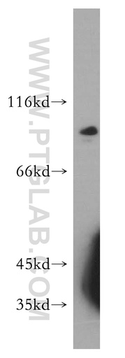 [17757-1-AP-150UL] SPIRE2 Polyclonal antibody