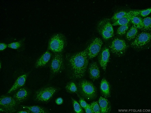 [17759-1-AP-20UL] CNDP1 Polyclonal antibody