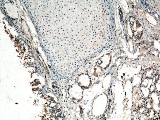 [17762-1-AP-20UL] GM-CSF Polyclonal antibody