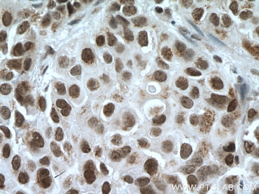 [17763-1-AP-20UL] CDYL Polyclonal antibody