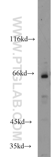 [17765-1-AP-150UL] HSF5 Polyclonal antibody