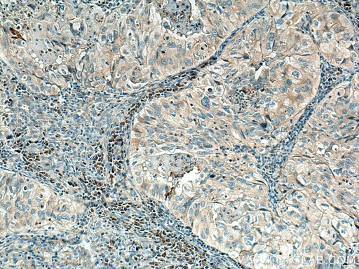 [17768-1-AP-20UL] MYO1E Polyclonal antibody
