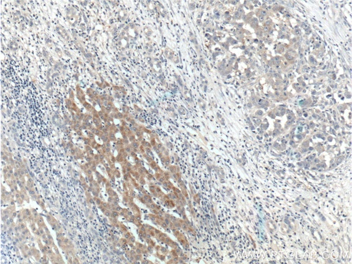 [17769-1-AP-150UL] BMP9 Polyclonal antibody