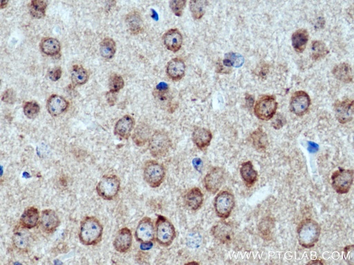 [17770-1-AP-20UL] CACNB4 Polyclonal antibody