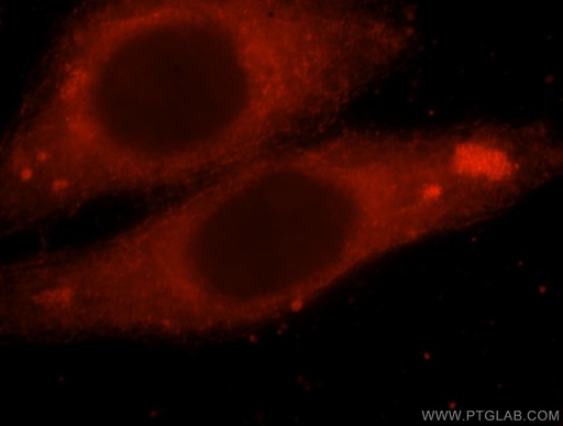 [17771-1-AP-150UL] PDE7B Polyclonal antibody