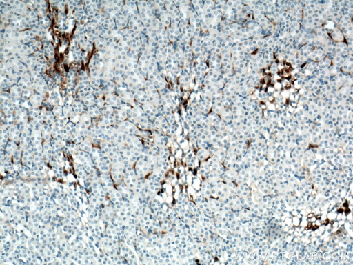 [17774-1-AP-150UL] GPR126 Polyclonal antibody