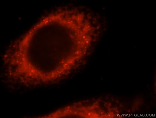 [17775-1-AP-150UL] KLHL32 Polyclonal antibody