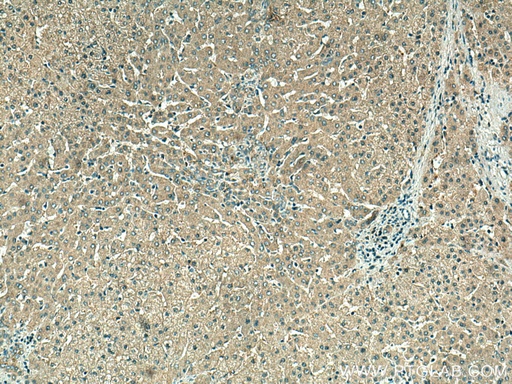 [17776-1-AP-150UL] VPS16 Polyclonal antibody