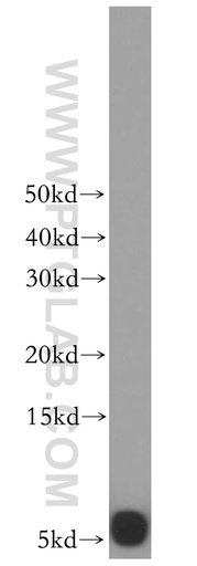 [17779-1-AP-150UL] UCRC Polyclonal antibody