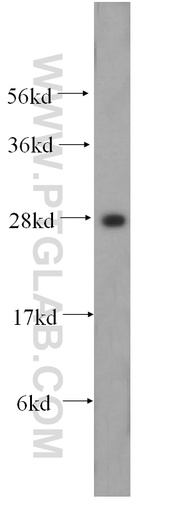 [17780-1-AP-20UL] HOXD4 Polyclonal antibody