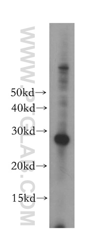 [17784-1-AP-150UL] ORC6 Polyclonal antibody