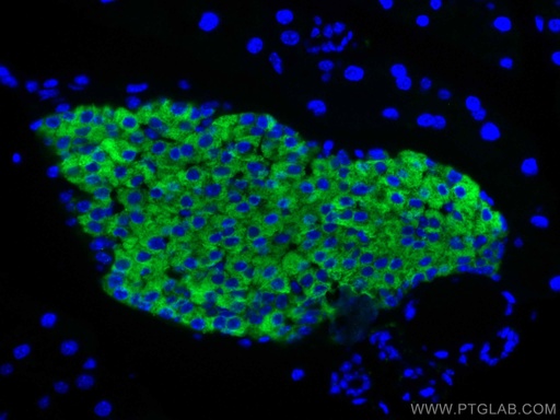 [17785-1-AP-20UL] Synaptophysin Polyclonal antibody