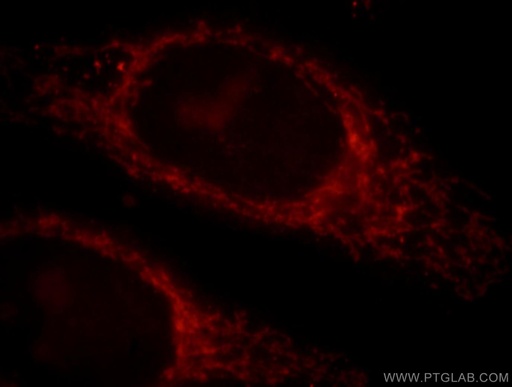 [17788-1-AP-150UL] MAPKBP1 Polyclonal antibody