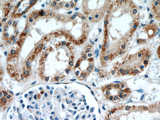 [17796-1-AP-20UL] ANT1/2 Polyclonal antibody
