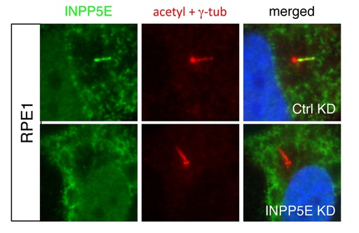 [17797-1-AP-150UL] INPP5E Polyclonal antibody