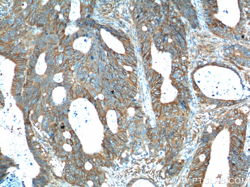 [17799-1-AP-150UL] PTK7 Polyclonal antibody