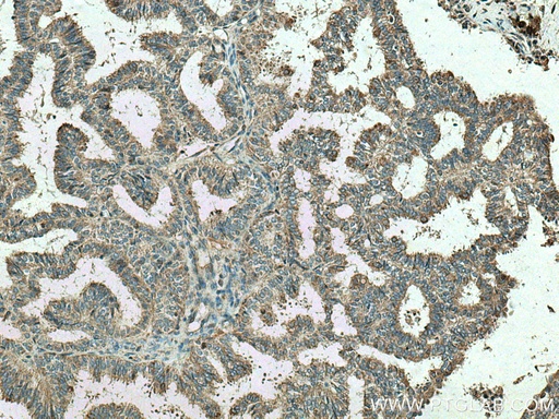 [17802-1-AP-20UL] VCPIP1 Polyclonal antibody