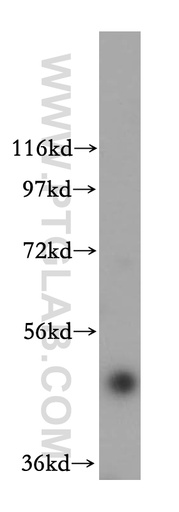 [17803-1-AP-150UL] FBXO3 Polyclonal antibody