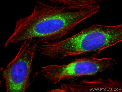 [17804-1-AP-20UL] Calumenin Polyclonal antibody