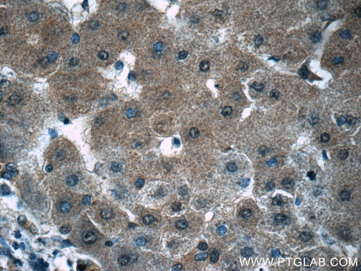 [17811-1-AP-150UL] PGK1 Polyclonal antibody