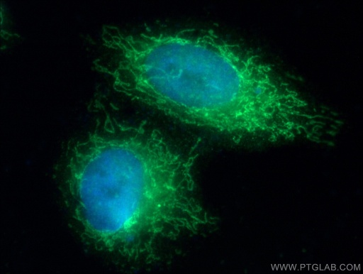 [17812-1-AP-150UL] COQ10A Polyclonal antibody