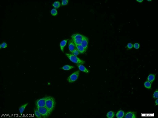 [17814-1-AP-150UL] PRPSAP2 Polyclonal antibody