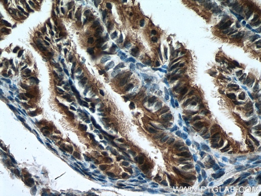 [17816-1-AP-150UL] RABL2A Polyclonal antibody
