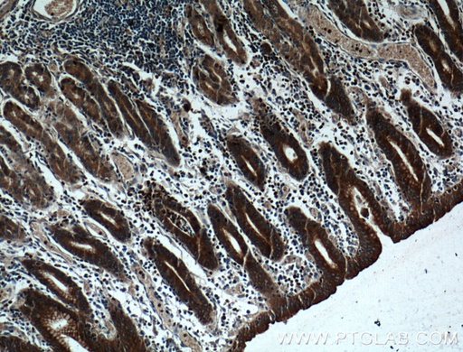 [17817-1-AP-150UL] RAB27A Polyclonal antibody