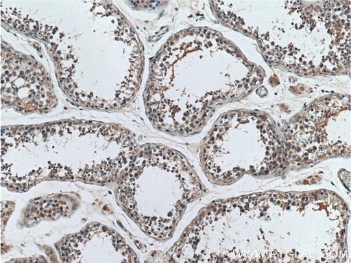 [17819-1-AP-20UL] SAPS1 Polyclonal antibody