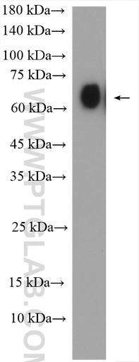 [17820-1-AP-150UL] SLC22A14 Polyclonal antibody