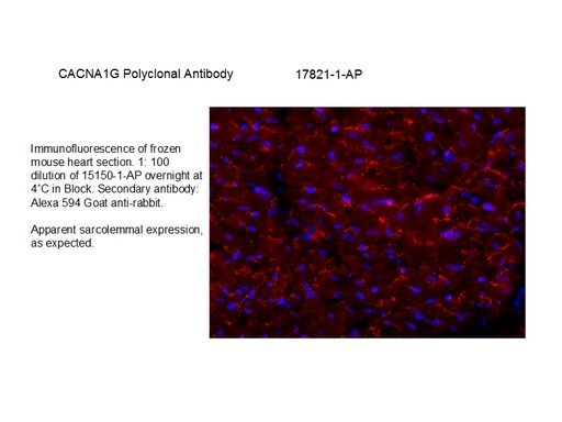 [17821-1-AP-150UL] CACNA1G Polyclonal antibody