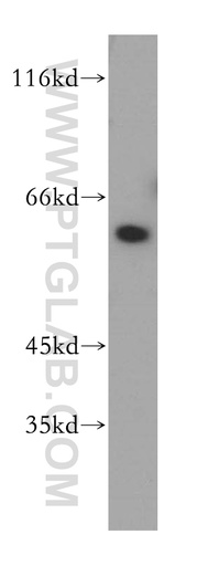 [17822-1-AP-150UL] DOK1 Polyclonal antibody