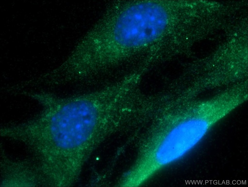 [17824-1-AP-150UL] RAB1B Polyclonal antibody