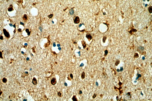 [17825-1-AP-20UL] TCEA1 Polyclonal antibody