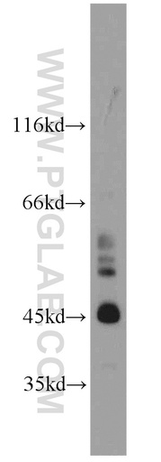 [17826-1-AP-150UL] SPERT Polyclonal antibody